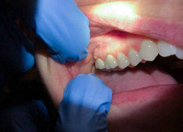 Best Walk-In Emergency Dentist in Johnsonville, SC